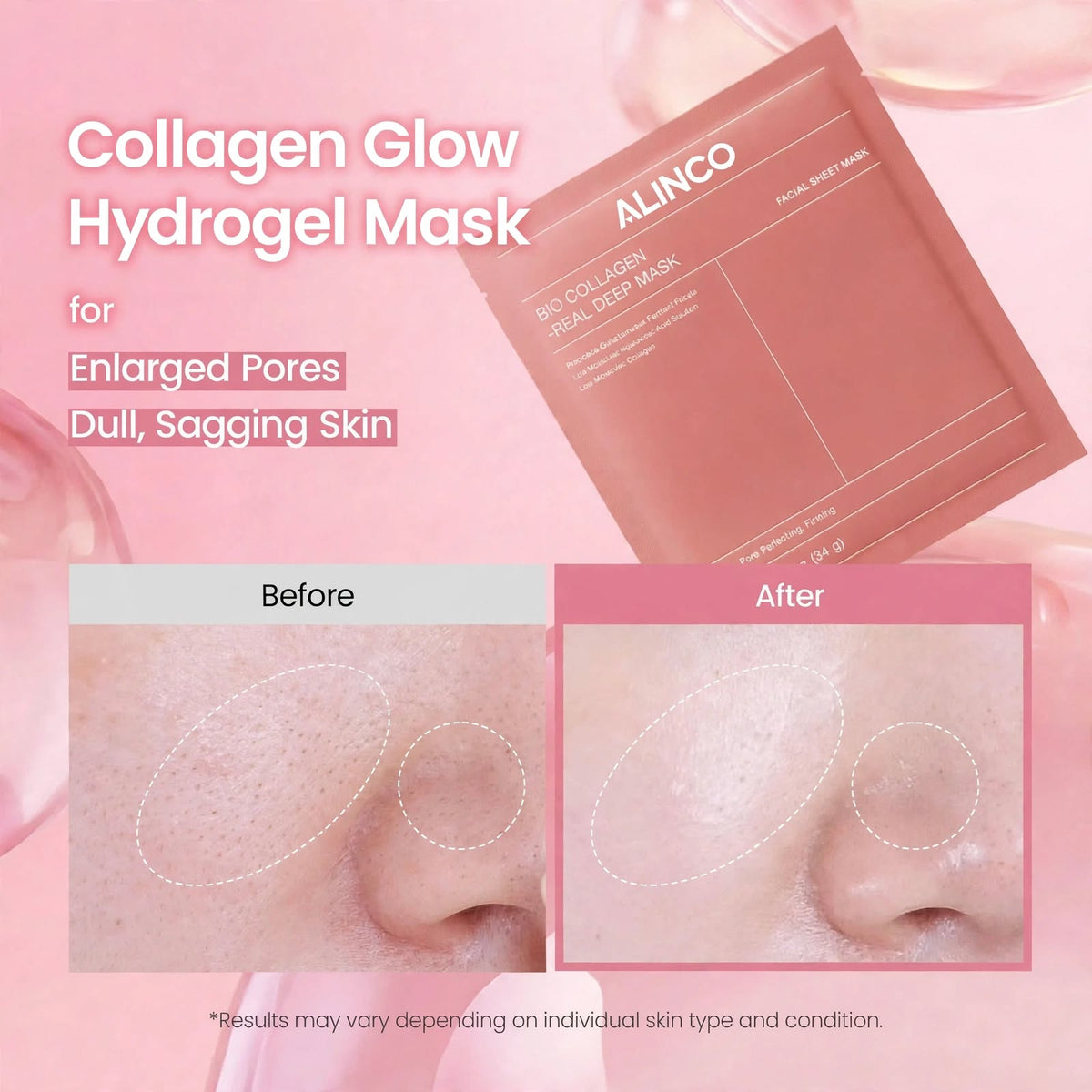 ALINCO BIO COLLAGEN- REAL DEEP MASK